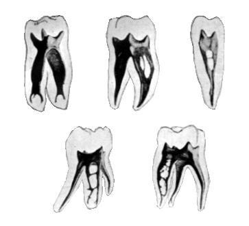 [CanalAnatomy6.jpg]