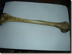 humerus (female) with hole in trochlea & rounded head, incomplete fusion at head,  21-22 years.