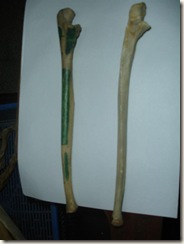 left (green markings) ulna has fusion on lower end(above 25 years), right has incomplete fusion at lower end (21-22 yrs).