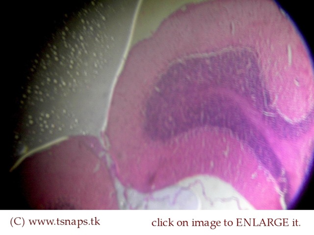[Cerebellum histology slide[2].jpg]