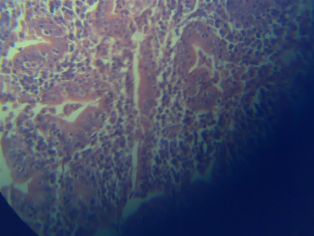 [Purkinje cells 2 histology slide[2].jpg]