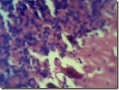 purkinje cells histology slide