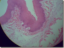 Stratified squamous epithelium under microscope