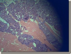 histology slide under microscope_thumb
