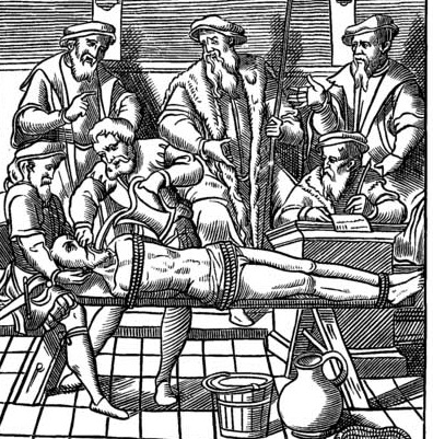[Medieval Water Torture[2].jpg]