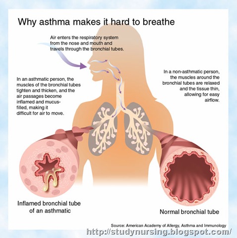[asthma[8].jpg]