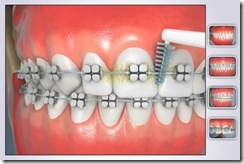 higiene oral