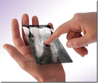 radiografia digital