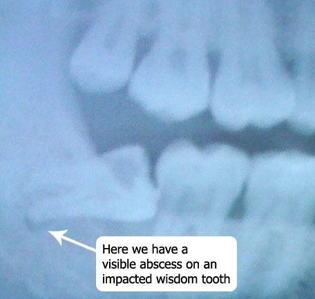 [toothy[4].jpg]