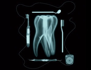 [radiografia higiene dental[4].jpg]