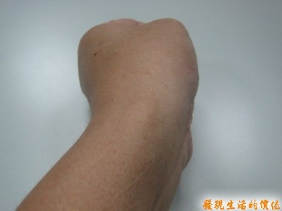 [ganglion_after03[3].jpg]