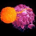 [cancer[2].jpg]