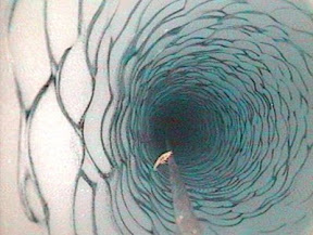 Descubren vida avanzada bajo hielos antárticos