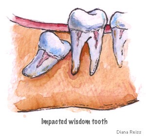 [odontectomy[5].jpg]