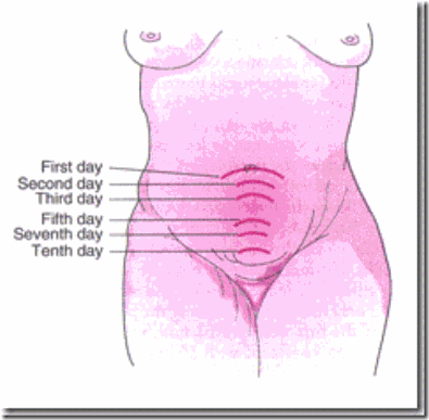 clip_image002