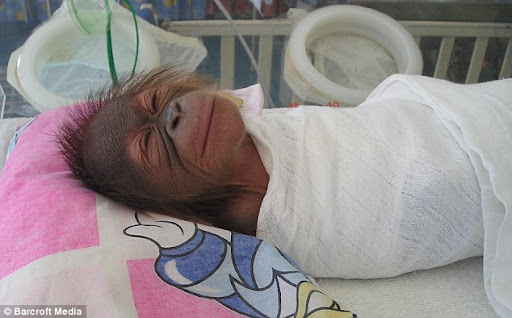 World's Only Orangutang Hospital