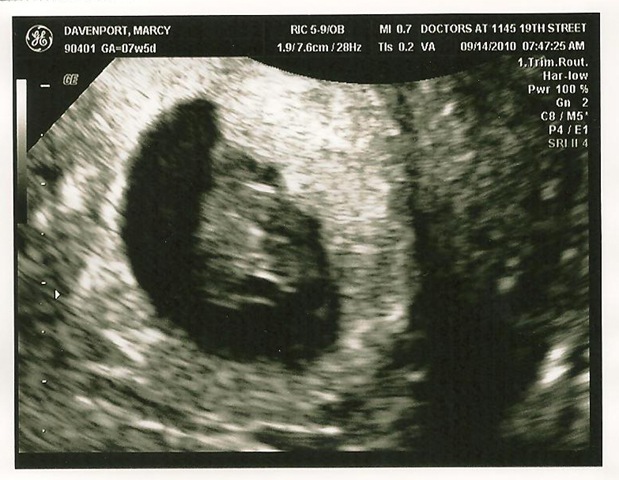 [baby 7 weeks 1[2].jpg]