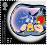 [medical breakthroughs[64].jpg]