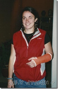 broken arm1