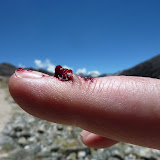 Dee shows her bloody finger. Charged with excess red blood cells in comes out looking like ketchup.