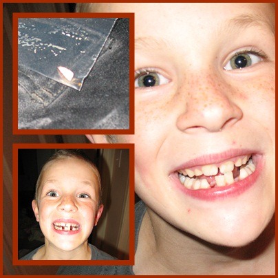[pageteeth[3].jpg]