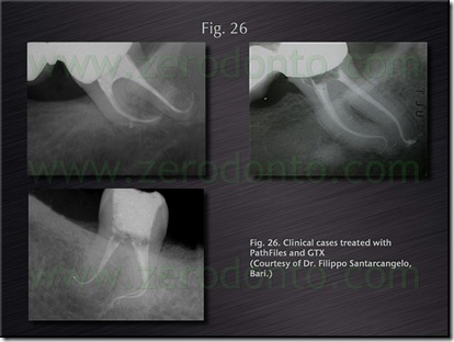 cast.028