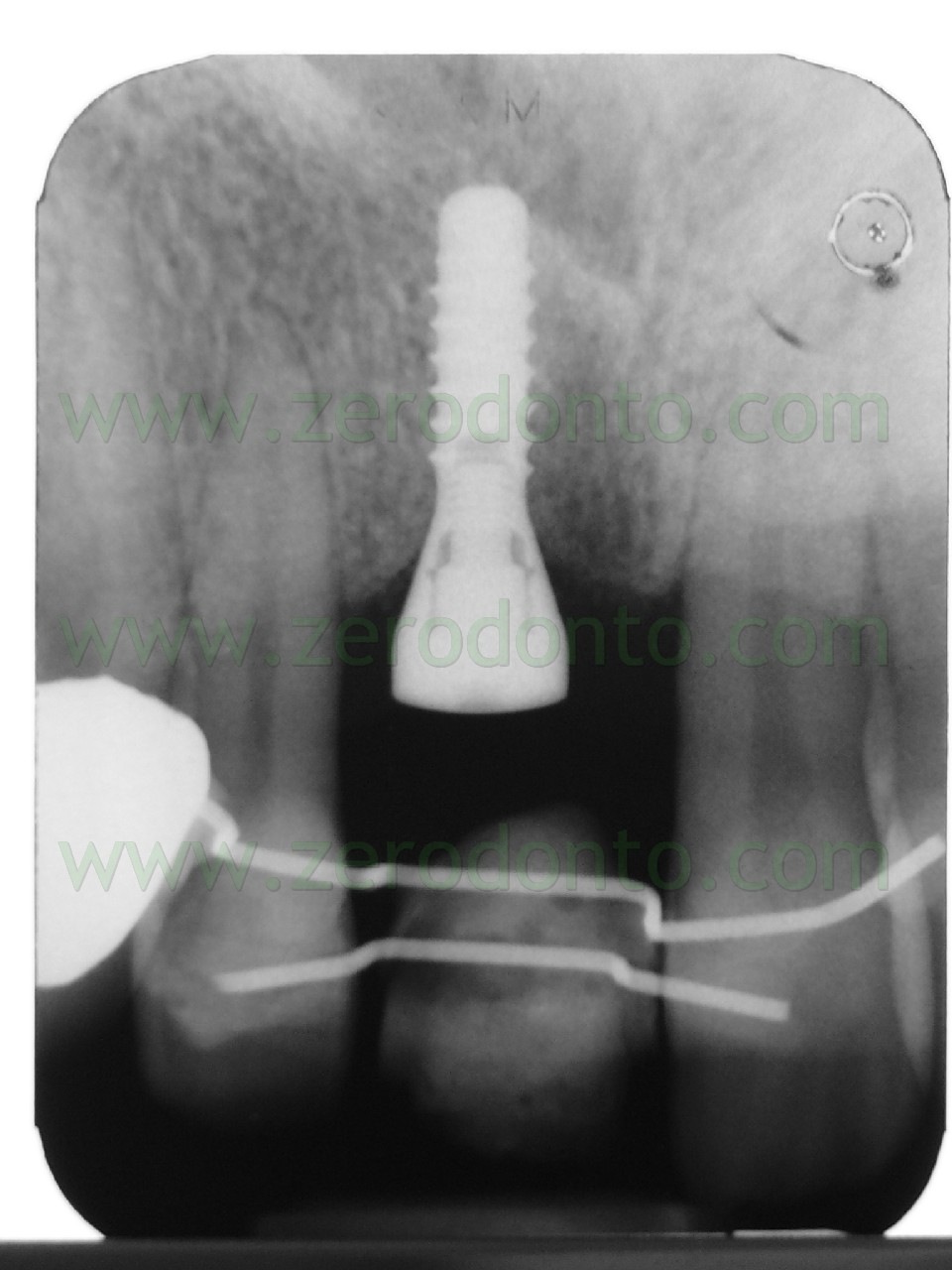 [P1020594[2].jpg]
