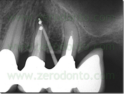 Fig. 07a
