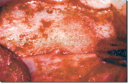 Fig. 10