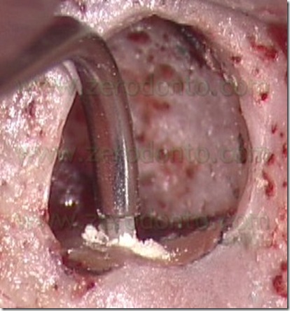 Fig. 55d