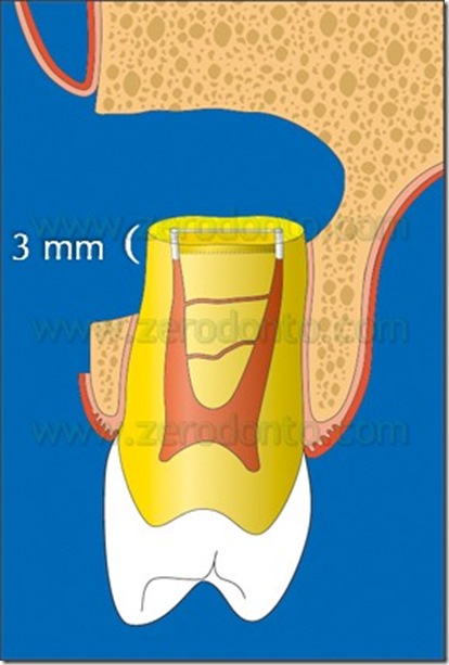 Fig. 33 Fig. 33