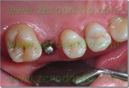 clip_image004
