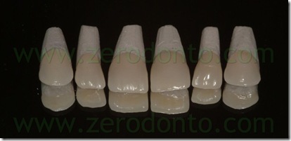 modello refrattario