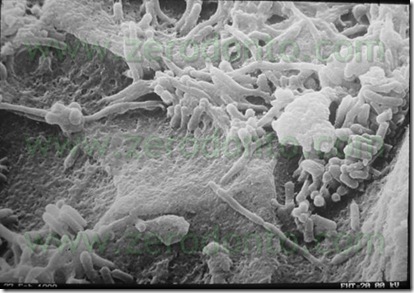 tetraclean sem