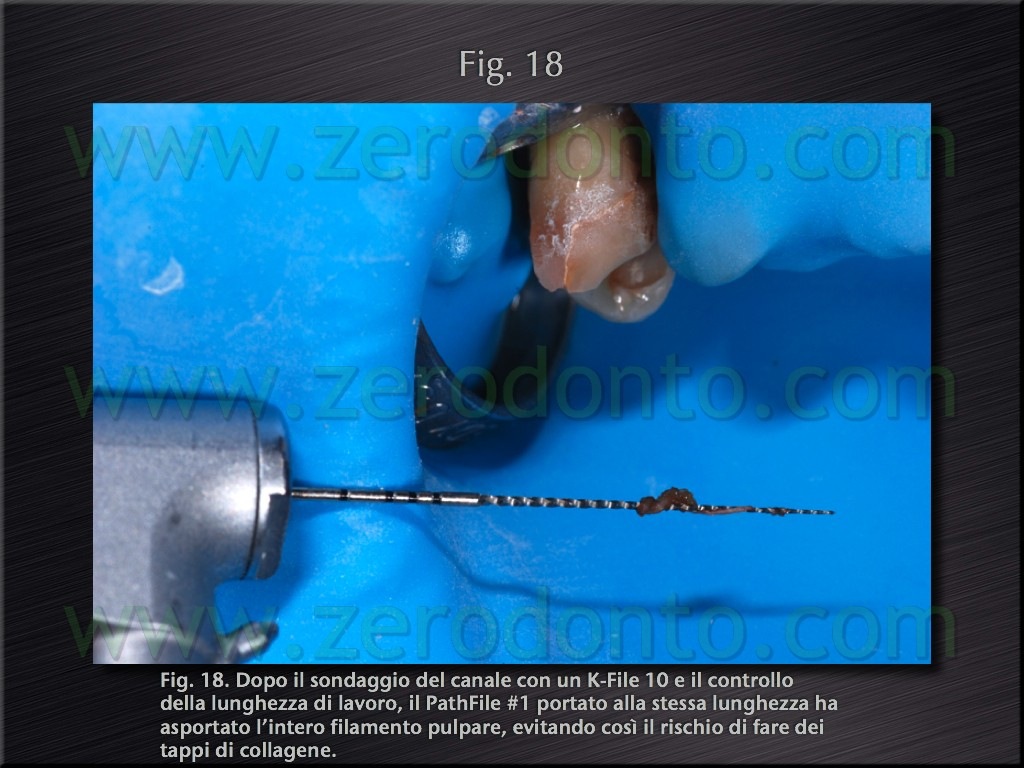 [Fig.18[4].jpg]