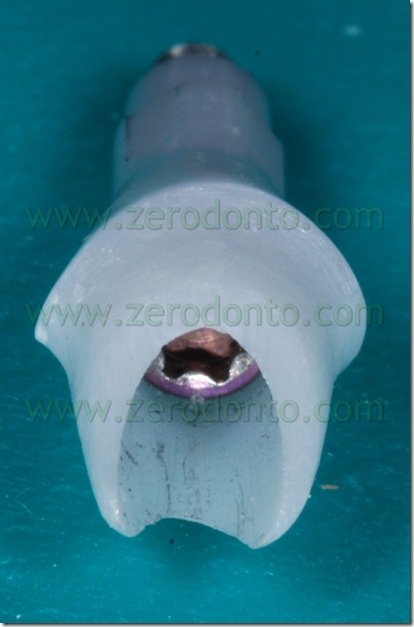 etkon moncone zirconio