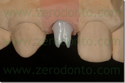 moncone cares straumann