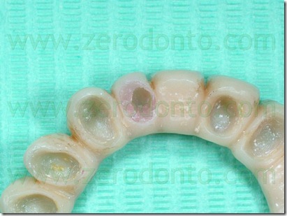 impronta in silicone