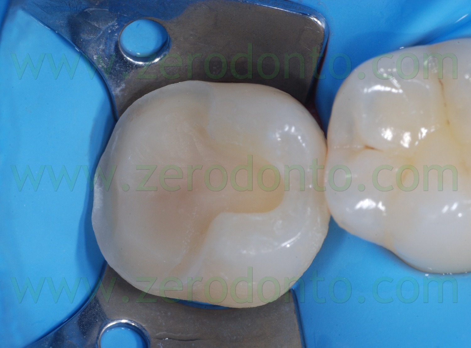 [Fig0068Rosti Q4[2].jpg]