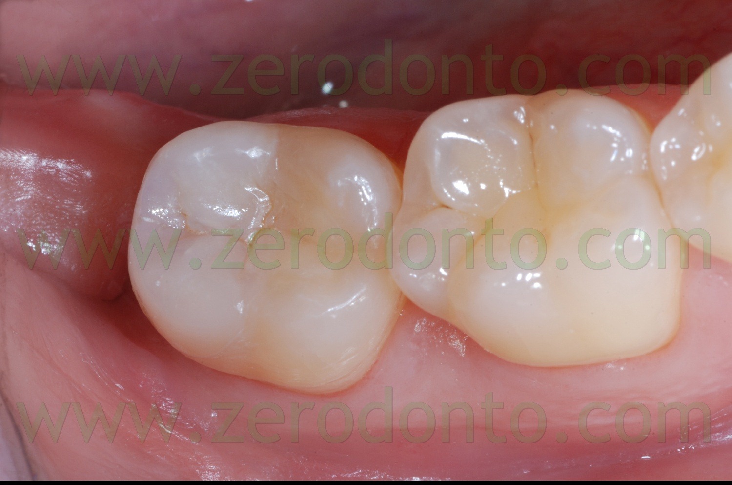 [Fig0070Rosti Q4[2].jpg]