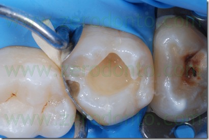Fig0055Rosti Q2