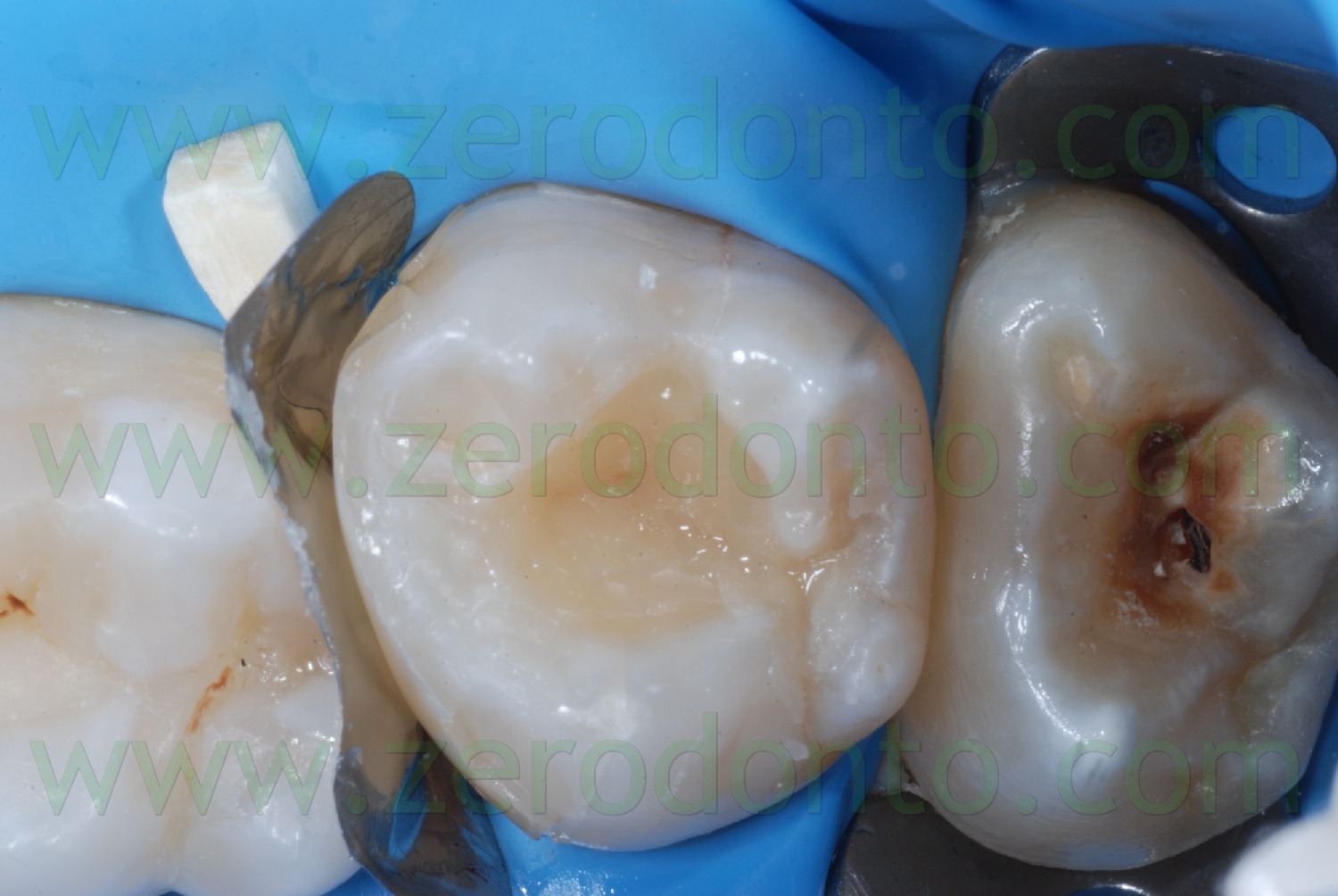 [Fig0056Rosti Q2[2].jpg]