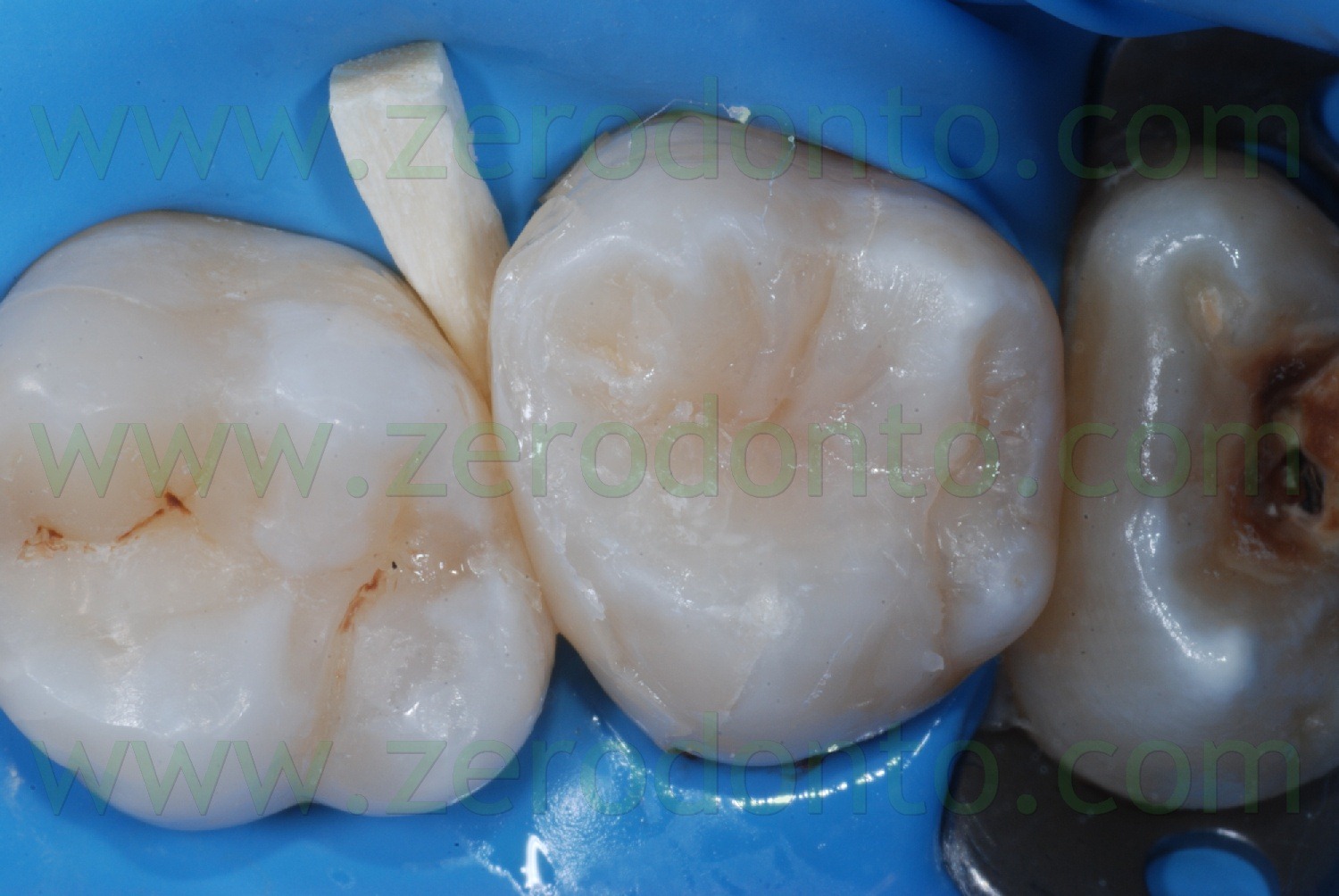 [Fig0058Rosti Q2[2].jpg]