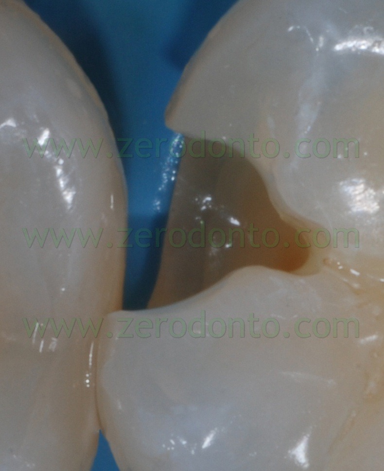 [Fig0073Rosti Q4[8].jpg]