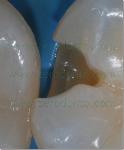 Fig0073Rosti Q4