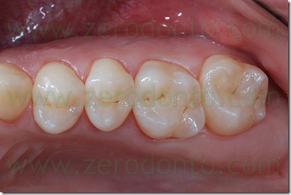 Fig0061Rosti Q2