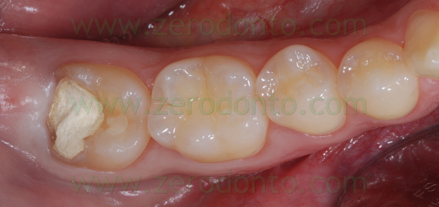 [Fig0062Rosti Q4[13].jpg]