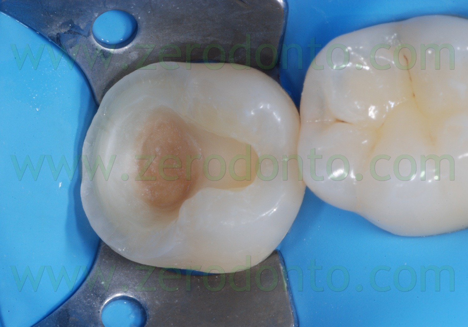 [Fig0065Rosti Q4[2].jpg]