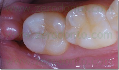 Fig0067Rosti Q4