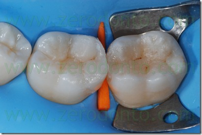 Fig0091Rosti Q3